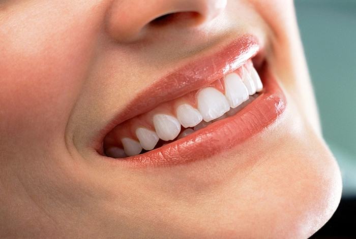 Woman smiling with bright white teeth.
