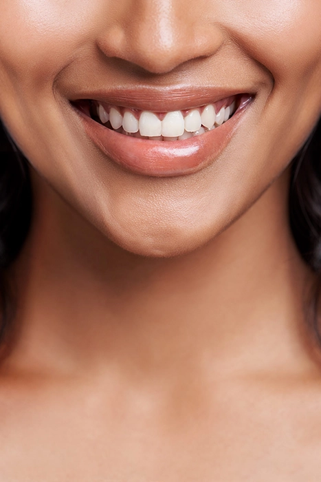 Vertical closeup of a woman's smile, teeth showing.