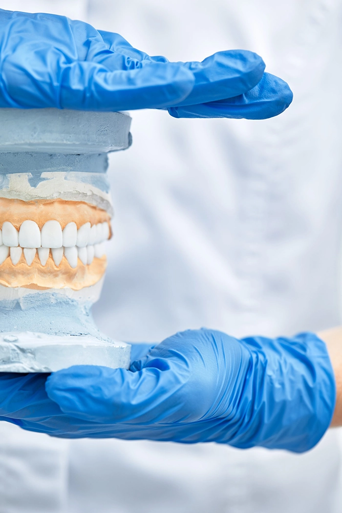 Dentist wearing blue gloves, holding a model of dentures.