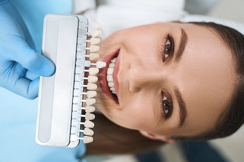 Woman smiling while dentist color matches her teeth.
