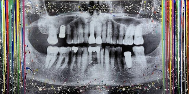 Abstract tooth x-ray painting by Dr. Ahmed